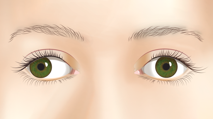 Nærbillede af øjne, der skeler